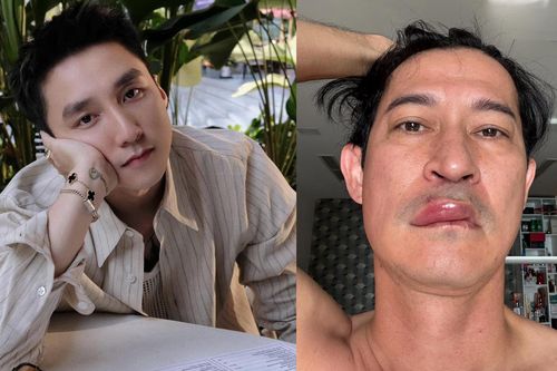 Sao Việt 1/4: Sơn Tùng M-TP lại 'gây bão', Huy Khánh gặp sự cố sức khỏe
