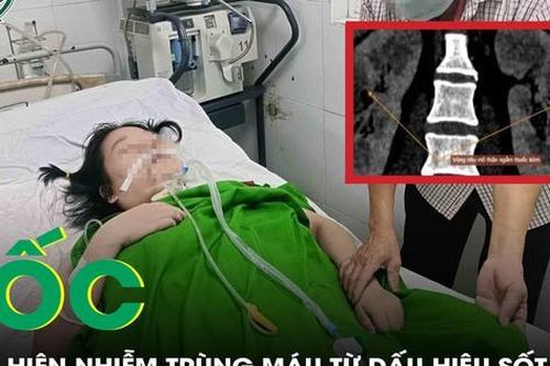 Bàng hoàng phát hiện nhiễm trùng máu từ dấu hiệu sốt vào chiều tối