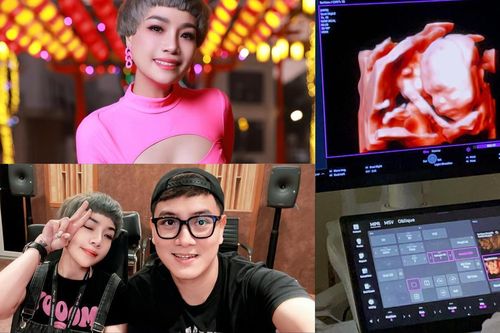 Ca sĩ Ngọc Khuê xác nhận mang thai, hé lộ ảnh siêu âm ngọt ngào