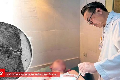 Nam sinh suýt mất mạng vì chữa bỏng sai cách