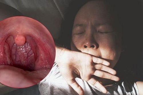 Đau họng khi ngáp là bệnh gì, có nguy hiểm không?