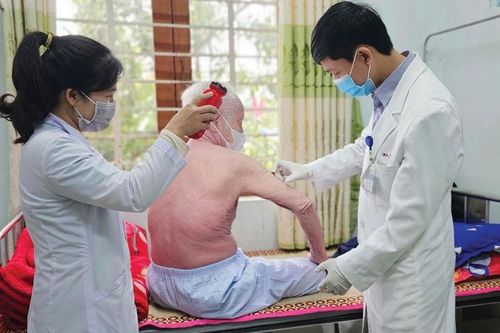Khổ sở vì bệnh vảy nến