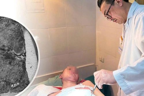 Bé trai 14 tuổi bị hoại tử nặng vì một thói quen nhiều người vẫn hay làm