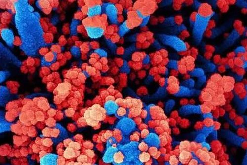 Nga lên tiếng về loại virus chưa xác định gây ra tình trạng sốt và ho ra máu