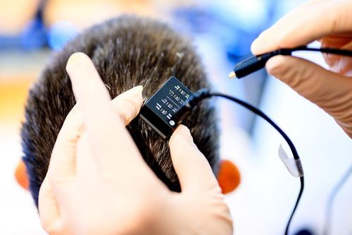 Thiết bị biến suy nghĩ thành giọng nói tức thì