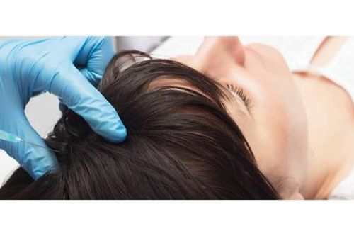 Các thuốc trị rụng tóc thời kỳ mãn kinh