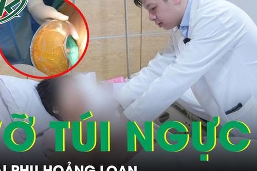 Thai phụ hoảng loạn vì vỡ túi ngực sau 7 năm nâng cấp
