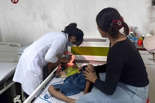 Xử lý thành công một bệnh nhi mắc nhiều dị vật đường thở