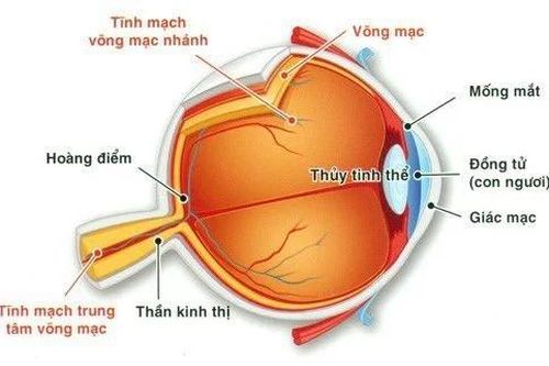 Người phụ nữ suýt mù vì bị tắc tĩnh mạch trung tâm võng mạc