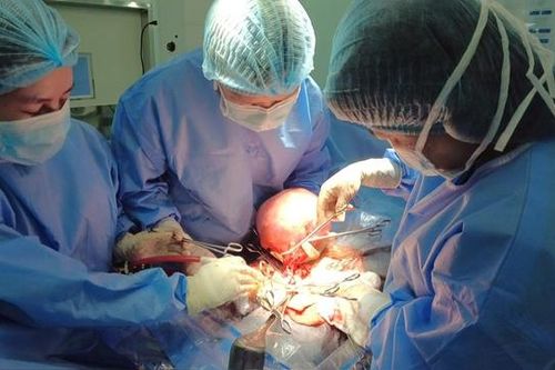 Bóc tách thành công khối u xơ tử cung nặng gần 3 kg cho bệnh nhân ở Đồng Nai