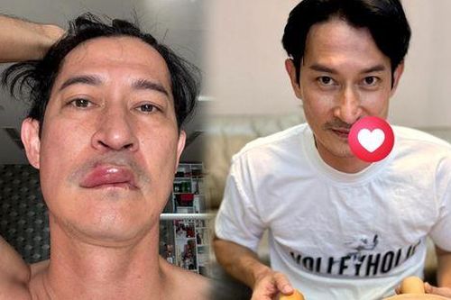Tình trạng hiện tại của Huy Khánh sau biến cố sức khỏe
