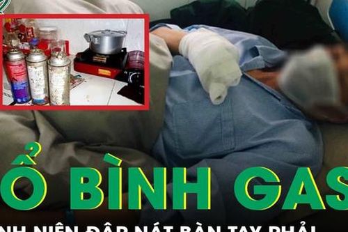 Nổ bình gas mini, thanh niên dập nát bàn tay phải, bỏng mặt, đa chấn thương