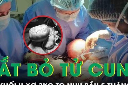 Phẫu thuật thành công khối u xơ tử cung nặng gần 3kg cho người phụ nữ 36 tuổi