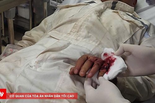 Nối thành công ngón tay của người nước ngoài bị đứt lìa