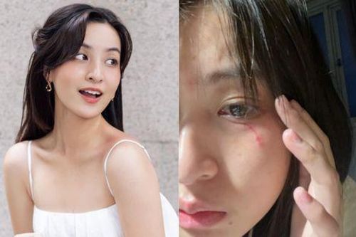 Sao nữ Vbiz bị thú cưng 'tấn công', tình trạng gây xót xa