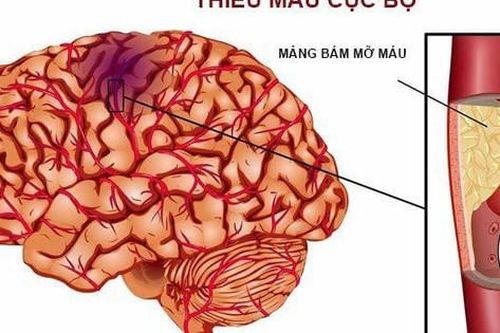 Cách phòng ngừa cục máu đông