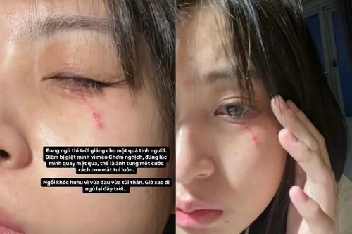 Nguyễn Lâm Thảo Tâm bị thú cưng 'tấn công', gương mặt bị ảnh hưởng