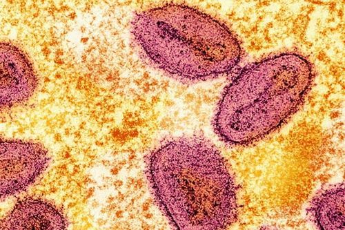 Cơ quan An ninh y tế Anh điều tra ca mắc đậu mùa khỉ chưa rõ nguồn lây