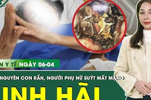 Bản tin Y tế 6/4: Nuốt nguyên con rắn, người phụ nữ tắc ruột vì hàng trăm mảnh xương