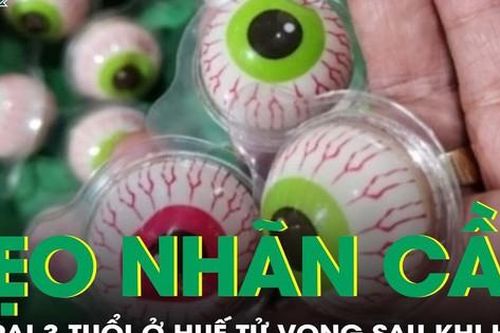 Bé trai 3 tuổi ở Huế tử vong thương tâm sau khi hóc kẹo hình con mắt