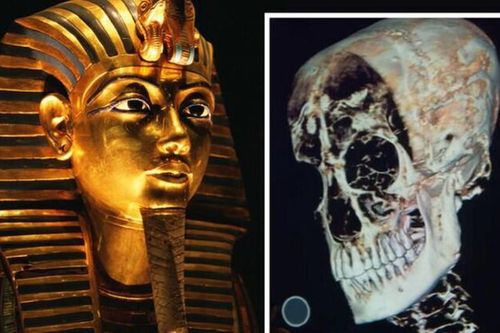 Phát hiện đột phá về cái chết của Vua Tutankhamun nhờ phân tích DNA