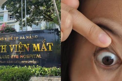 Bệnh viện Mắt Đà Nẵng giải thích nhân viên trừng mắt với bệnh nhân thực ra bị lồi mắt