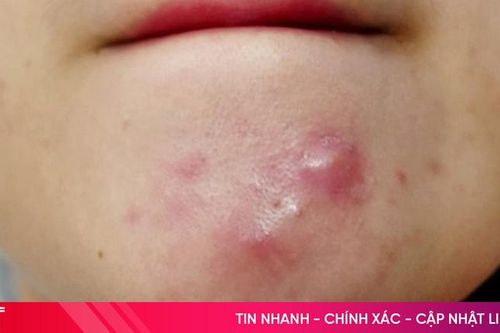 Top 6 dấu hiệu cho thấy bạn cần phải đi khám da liễu ngay!