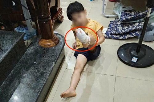 'Vật lạ' cứa chân người dân khi tắm biển ở Nha Trang