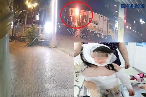 Quán cà phê bị ném 'bom xăng', bé gái 3 tuổi bỏng nặng