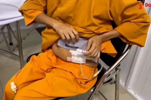 Bệnh viện Đa khoa Long Khánh áp dụng kỹ thuật mới lọc màng bụng để giảm lượng bệnh nhân chờ máy chạy thận
