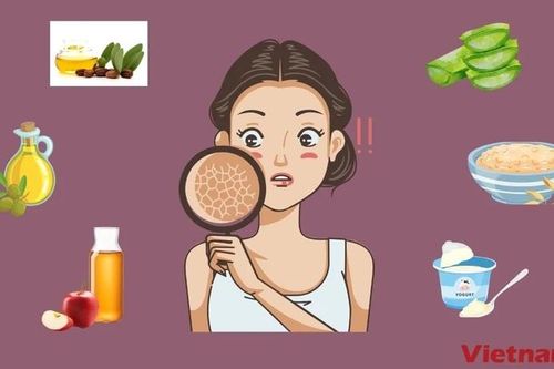 Mách bạn cách điều trị da mặt bị khô tróc vảy tại nhà