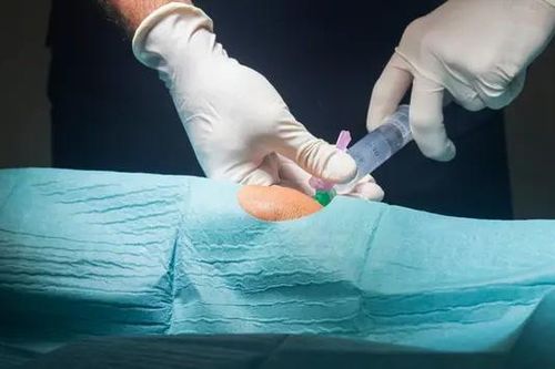 Điều trị thoái hóa khớp bằng sản phẩm tiên tiến