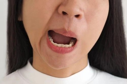 Sau cơn đau nhức trong tai, mặt người phụ nữ biến dạng