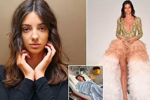 Lucy Markovic - Á quân 'Next Top Model' qua đời tuổi 27 sau hành trình chiến đấu bệnh tật