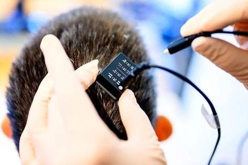 Cấy ghép não giúp biến suy nghĩ thành giọng nói 'gần như tức thì'