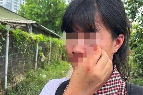 Nữ sinh bị nhóm bạn đánh hội đồng do mâu thuẫn khi chơi cùng nhóm