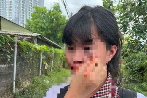 Điều tra vụ nữ sinh bị đánh hội đồng ở TP.Thủ Đức, mặt mũi, quần áo bê bết máu