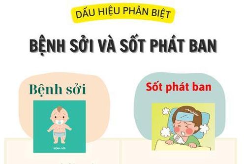 Hướng dẫn cách phân biệt bệnh sởi và sốt phát ban ở trẻ