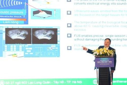Việt Nam áp dụng công nghệ mới loại bỏ khối u bằng sóng siêu âm hội tụ cường độ cao