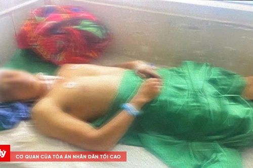 Vợ chém nhiều nhát nghi do ghen tuông