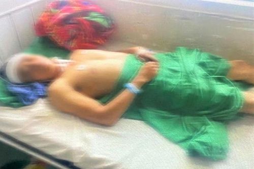 Đang ngủ, vợ dùng dao chém chồng nhập viện