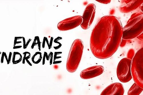 6 câu hỏi thường gặp về hội chứng Evans