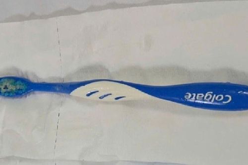 Hy hữu: Người phụ nữ nuốt bàn chải đánh răng dài 17cm vào thực quản