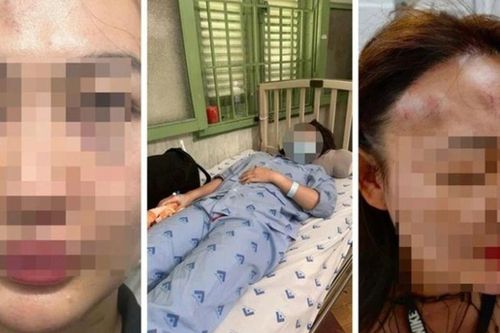 Vụ thanh niên 'bắt cá hai tay', đánh bạn gái bất tỉnh ở quán cà phê: Tình tiết mới nhất