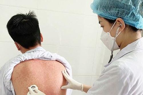Hà Nội: Số ca mắc sởi vẫn gia tăng