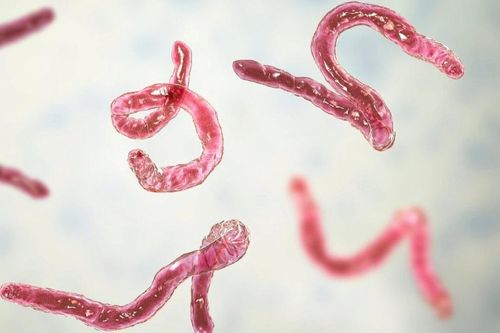 Dấu hiệu điển hình cảnh báo bạn nhiễm giun sán