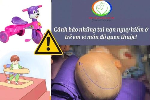 Bé 15 tháng tuổi tụ máu não do ngã xe 3 bánh