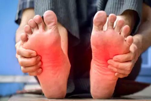 4 dấu hiệu ở bàn chân cảnh báo các vấn đề sức khỏe