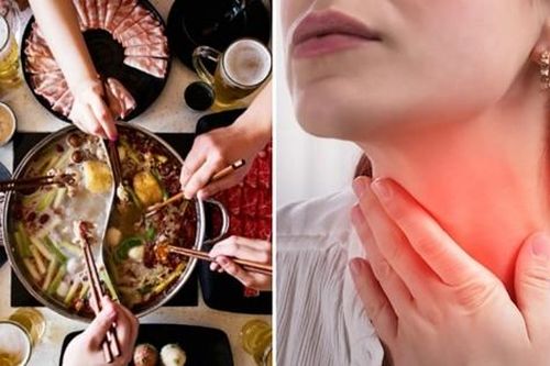 Sau khi ăn lẩu quá cay, một cô gái ở Trung Quốc bị đau họng rồi thiệt mạng