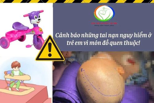 Trẻ tụ máu não do ngã từ xe ba bánh tập đi